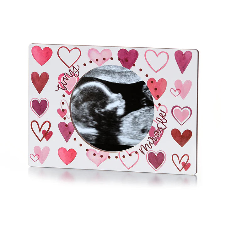 Tiny Miracle Magnetic Ultrasound Frame